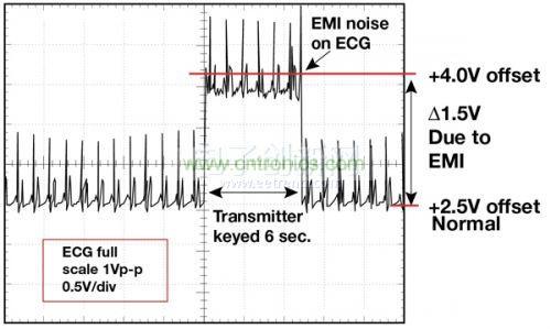 1.5 英尺以外的發(fā)射器(f = 470 MHz, P= 0.5W)開啟和關(guān)閉時ECG 診斷設(shè)備的心臟檢查結(jié)果